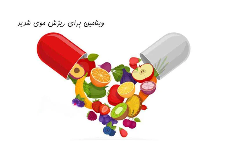 ویتامین ویتامین برای ریزش موی شدید