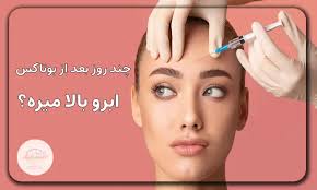 بوتاکس صورت بعد از چند روز اثر می کند؟ همه چیز درباره شروع و ماندگاری نتایج